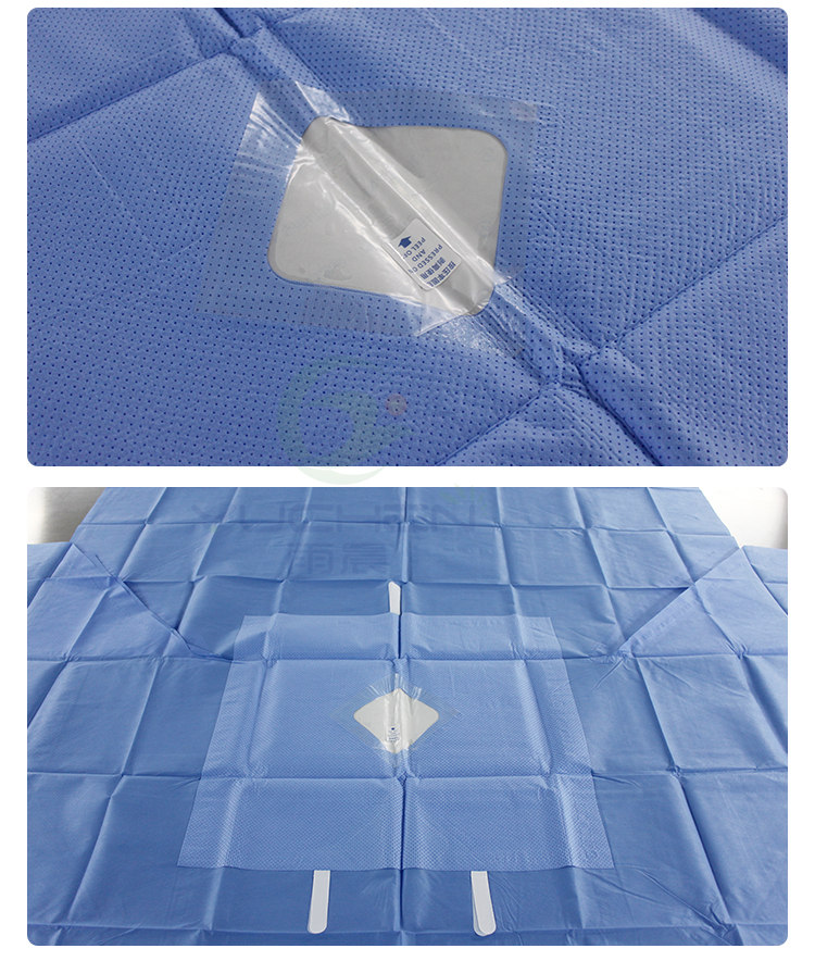 Tejido SMPE de 130 g/m² altamente absorbente como pieza reforzada para paño quirúrgico - YuChen